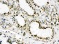 Anti-EWSR1 Picoband Antibody